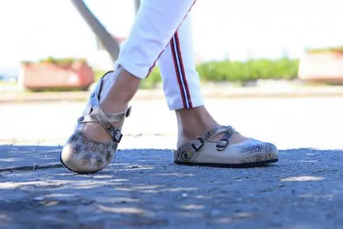 Clogs - CAL3204
